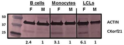 Lysosomal pH Is Regulated in a Sex Dependent Manner in Immune Cells Expressing CXorf21